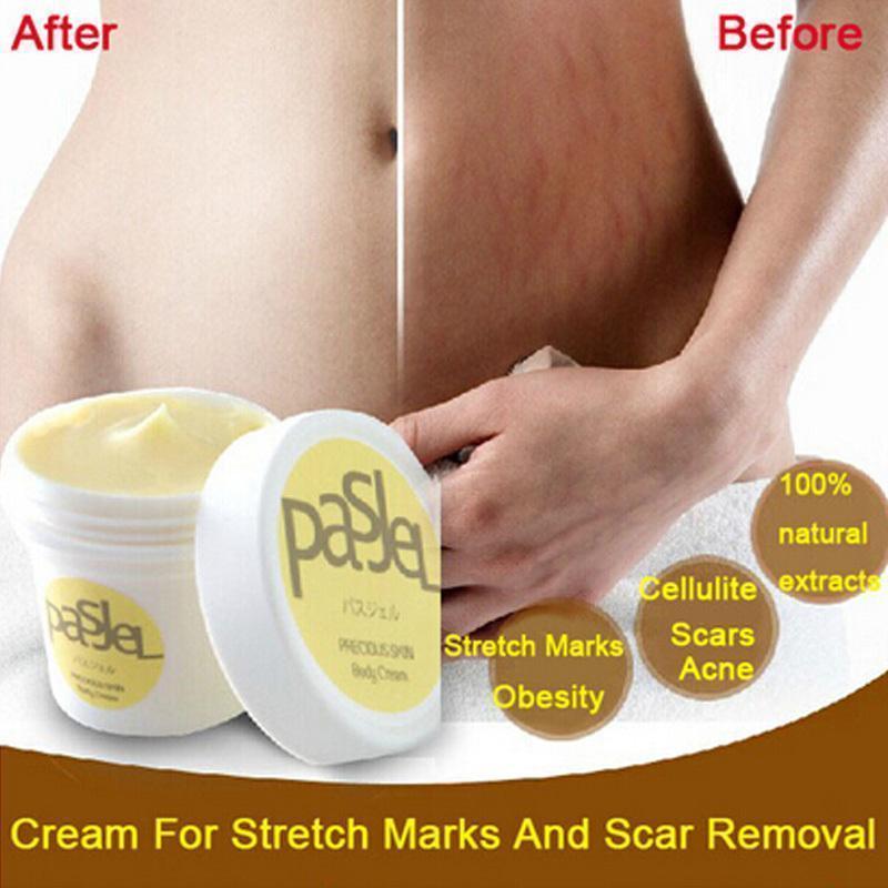 Pasjel Stretch Mark Cream