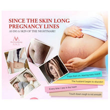 Powerful scar removal and Stretch Mark cream